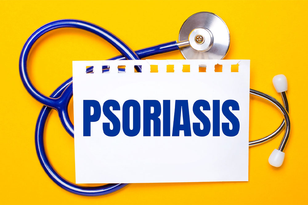 A comprehensive guide to plaque psoriasis