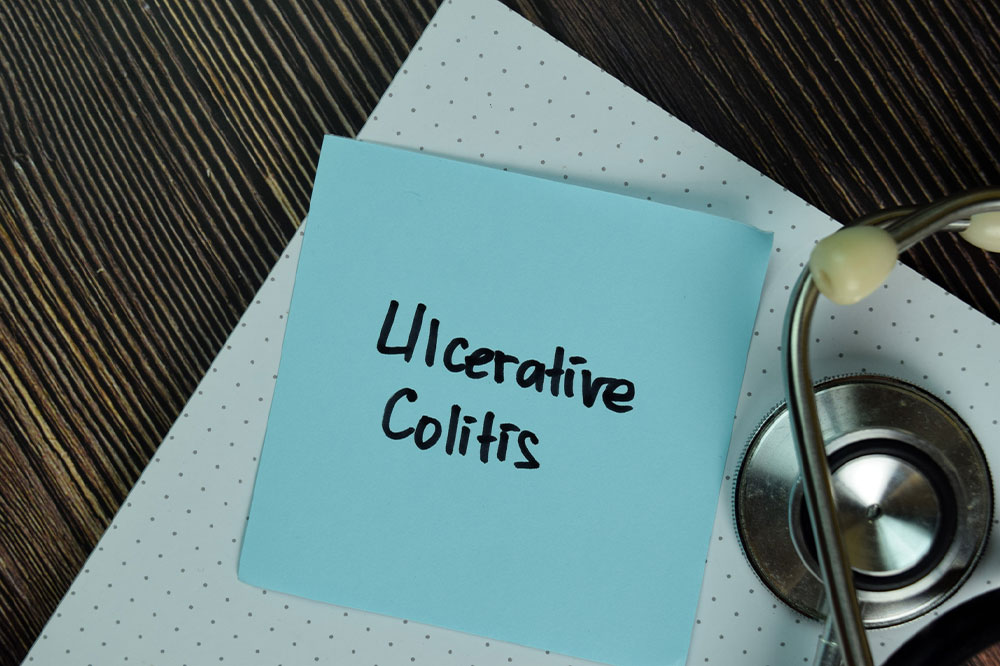 A comprehensive guide to ulcerative colitis