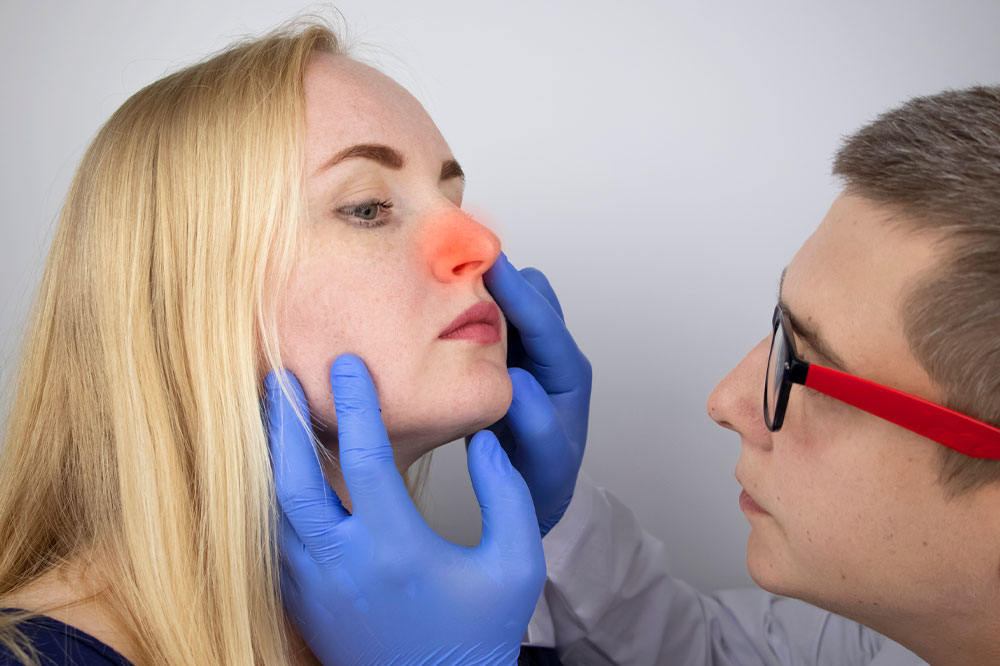 Causes, symptoms, and management of nasal polyps