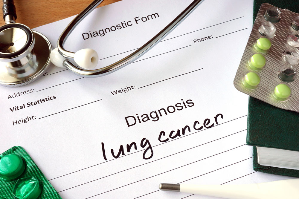 Lung cancer – Causes, symptoms, treatment, and nutrition