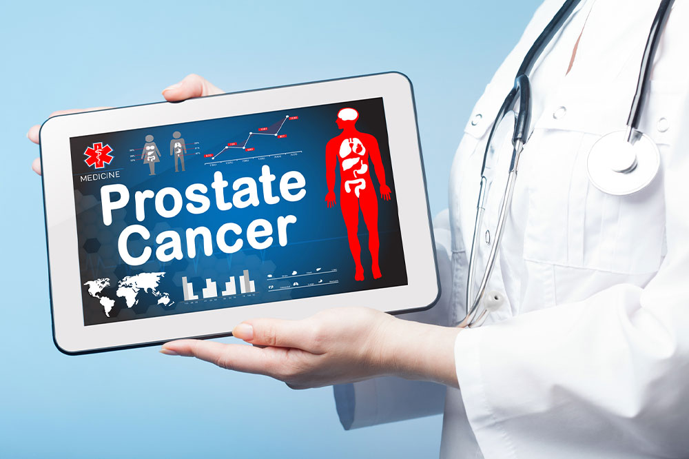 Prostate cancer – Its causes, symptoms, and management