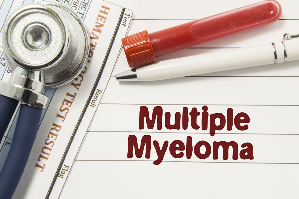 Top factors to consider about multiple myeloma