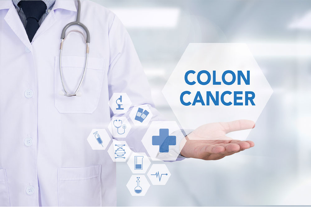 Colon cancer – Its causes, symptoms, and stages
