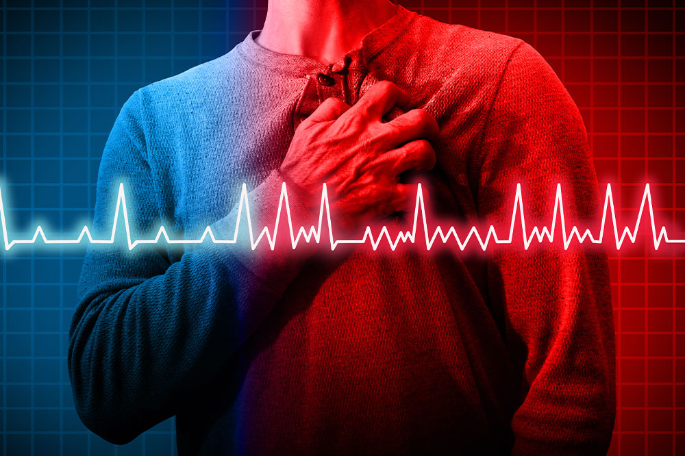 What is atrial fibrillation