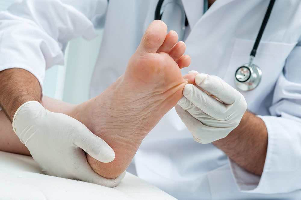 Edema – What is it and how it affects the body
