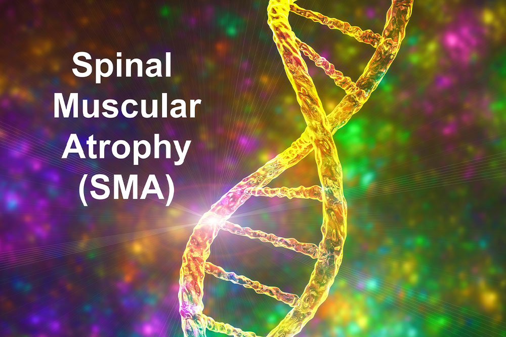 Types, signs and diagnosis of spinal muscular atrophy