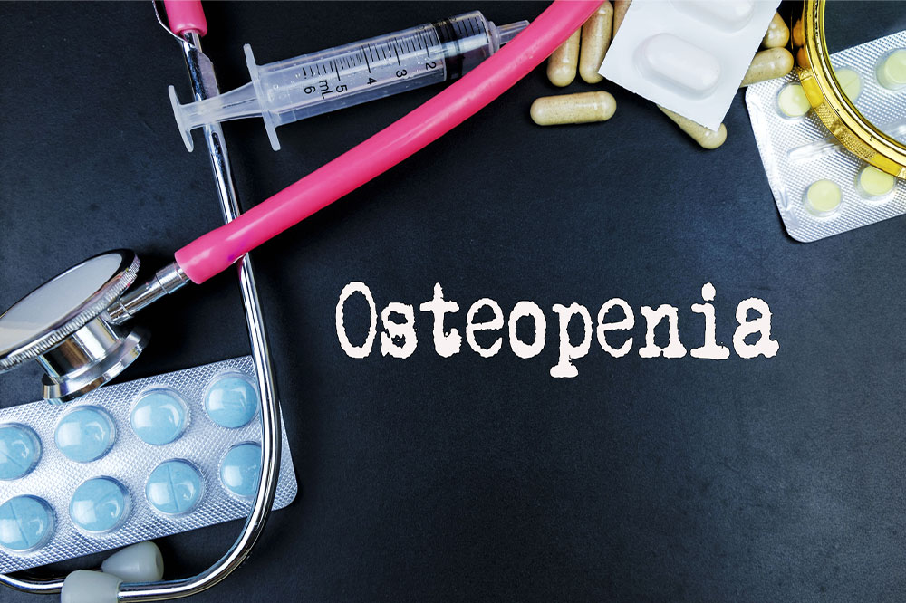 Osteopenia – Symptoms, causes, and management interventions
