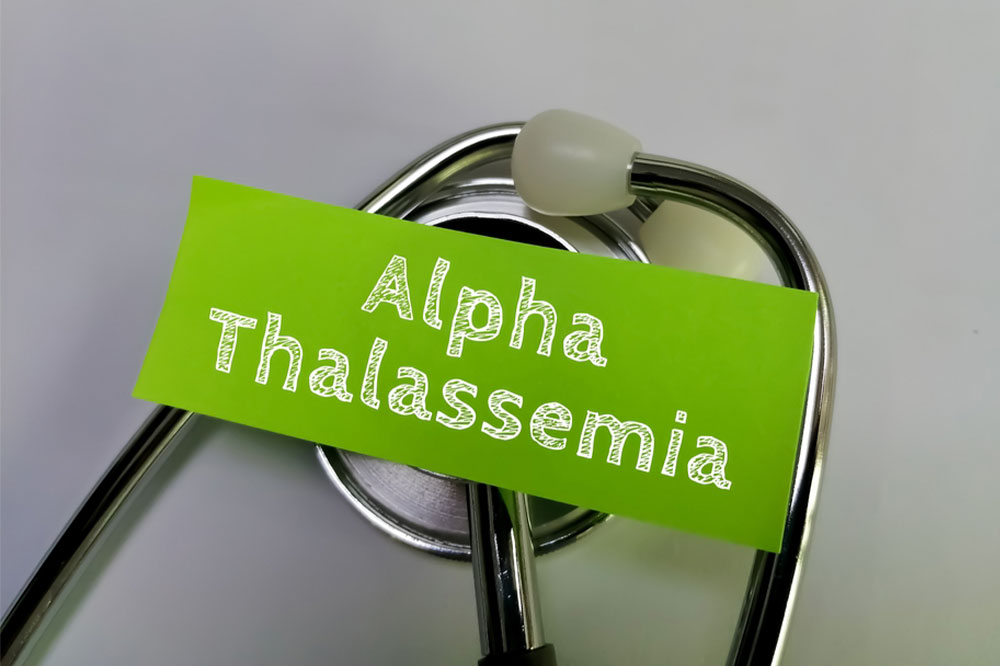 Alpha thalassemia – Types, causes, symptoms, and more