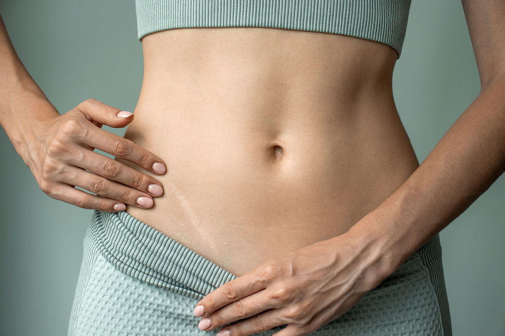 Everything about scar tissue, its types, and health impact