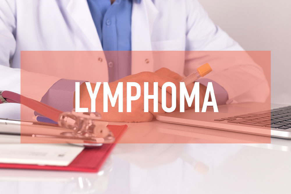 Lymphoma – Common symptoms and management options
