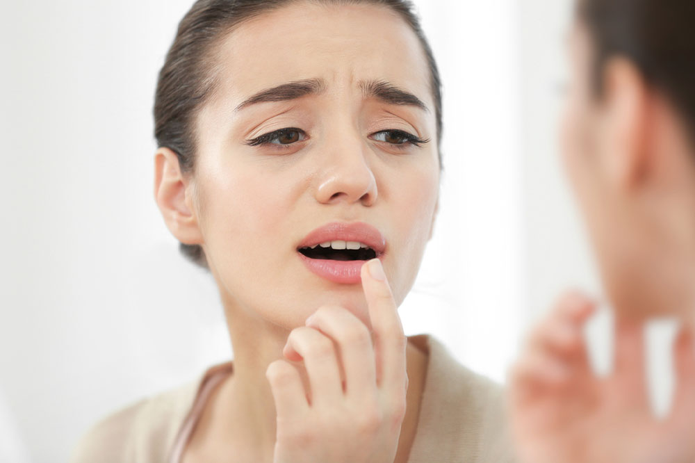 What are cold sores and how to manage them
