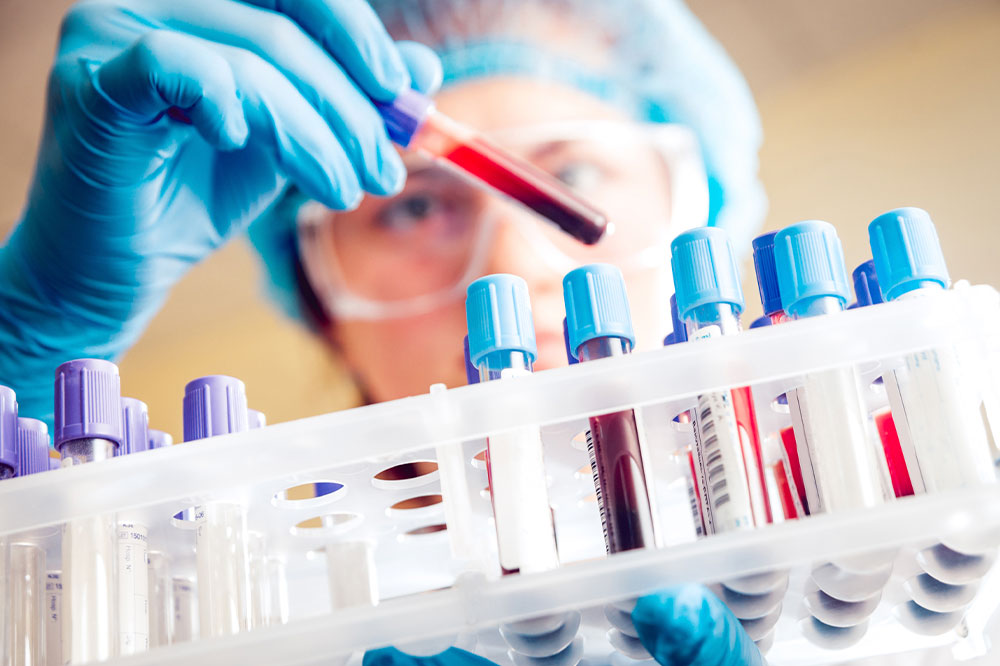 What is the alpha-fetoprotein test and its importance