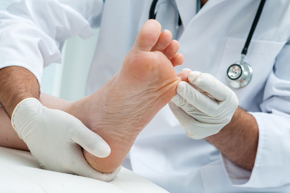 Here’s everything to know about nail psoriasis