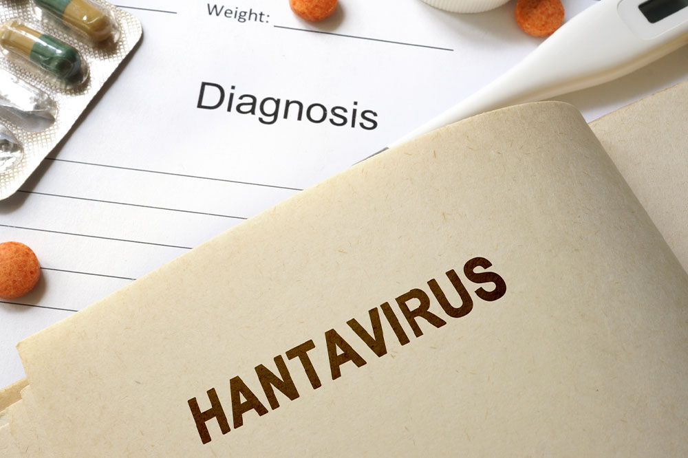 Hantavirus pulmonary syndrome – Symptoms, causes, and more