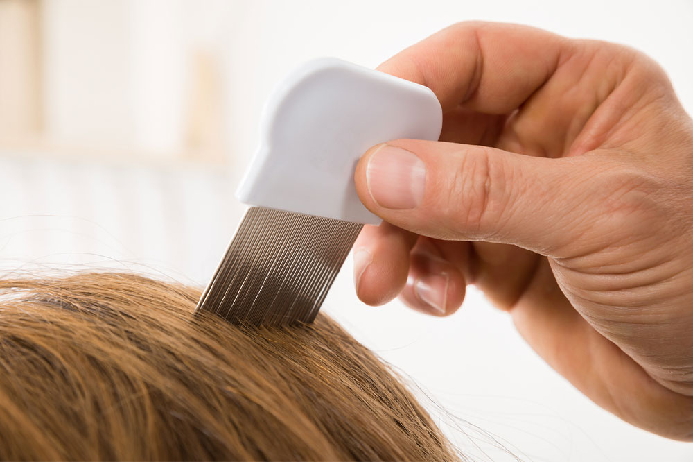 Head lice infestation – Signs, causes, remedies, and more