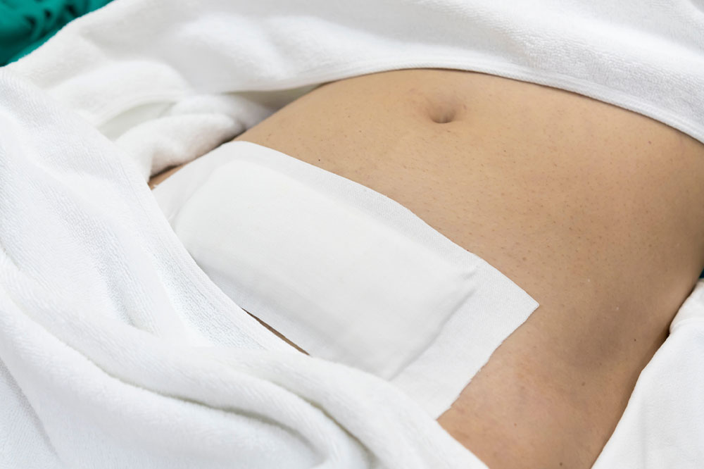 Myomectomy – Types and risks associated with it