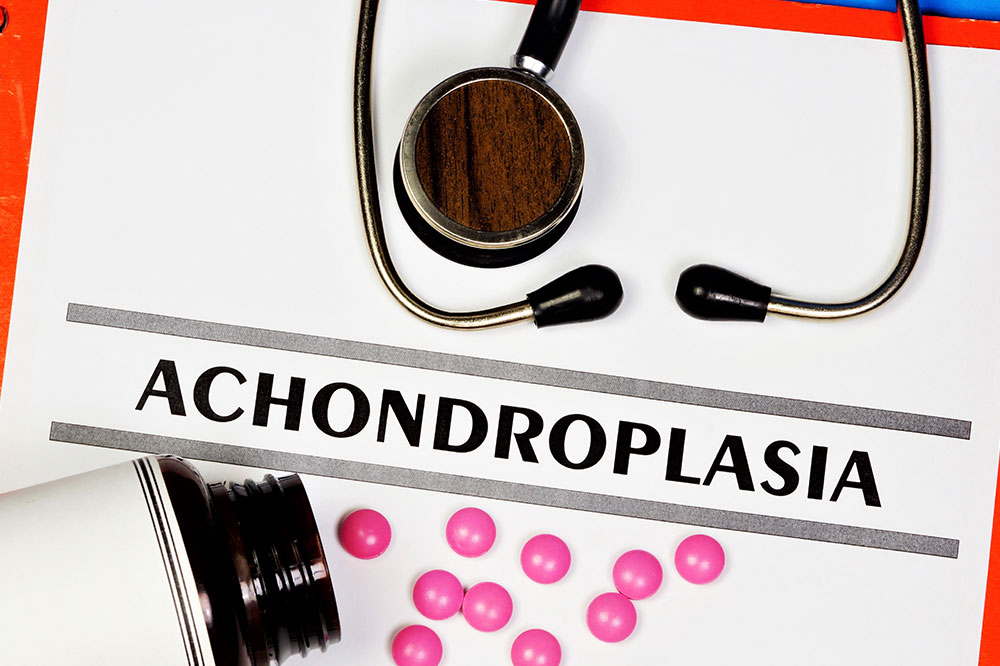 Achondroplasia – Causes, signs, and management