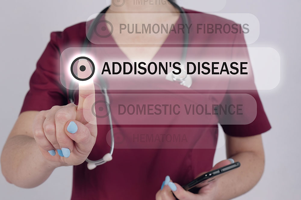 Addisons disease – Things to know about the condition