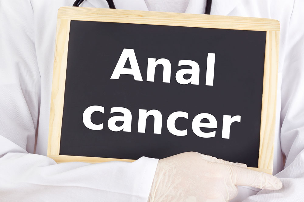 Anal cancer – Diagnosis, causes, and more