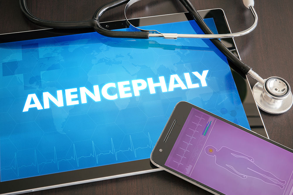 Anencephaly – Its dangers and managing the risk factors