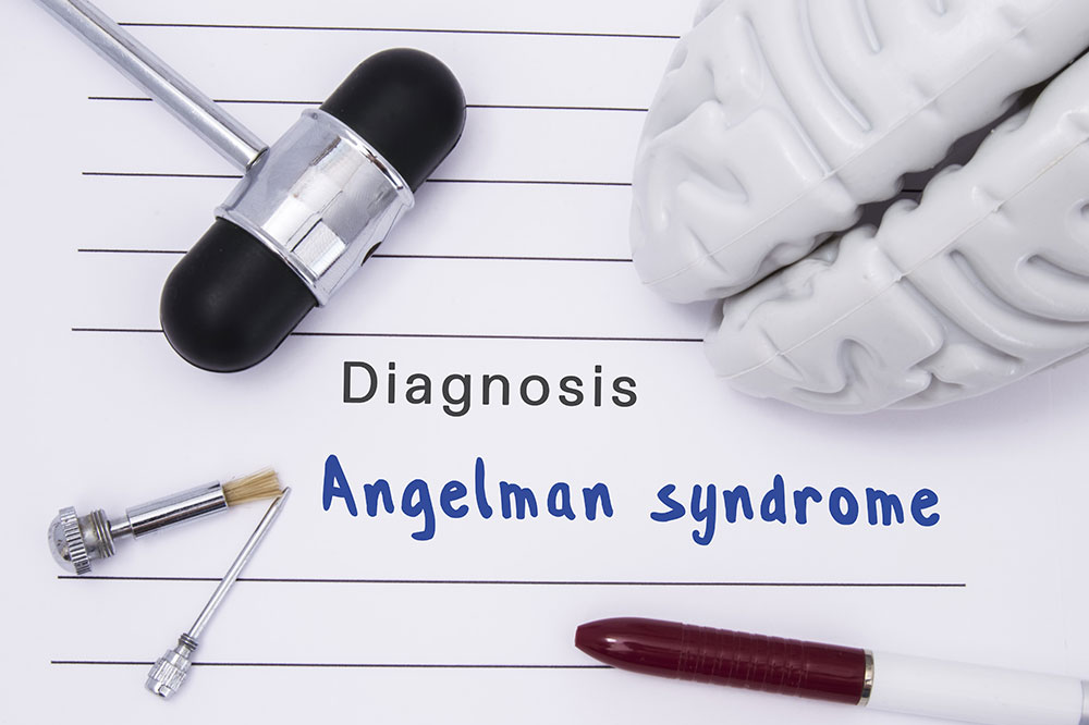 Angelman syndrome – Signs, causes, diagnosis, and management