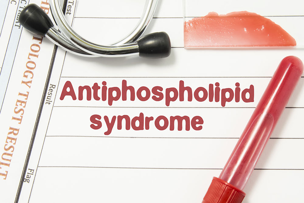 Antiphospholipid syndrome – Symptoms, causes, and management
