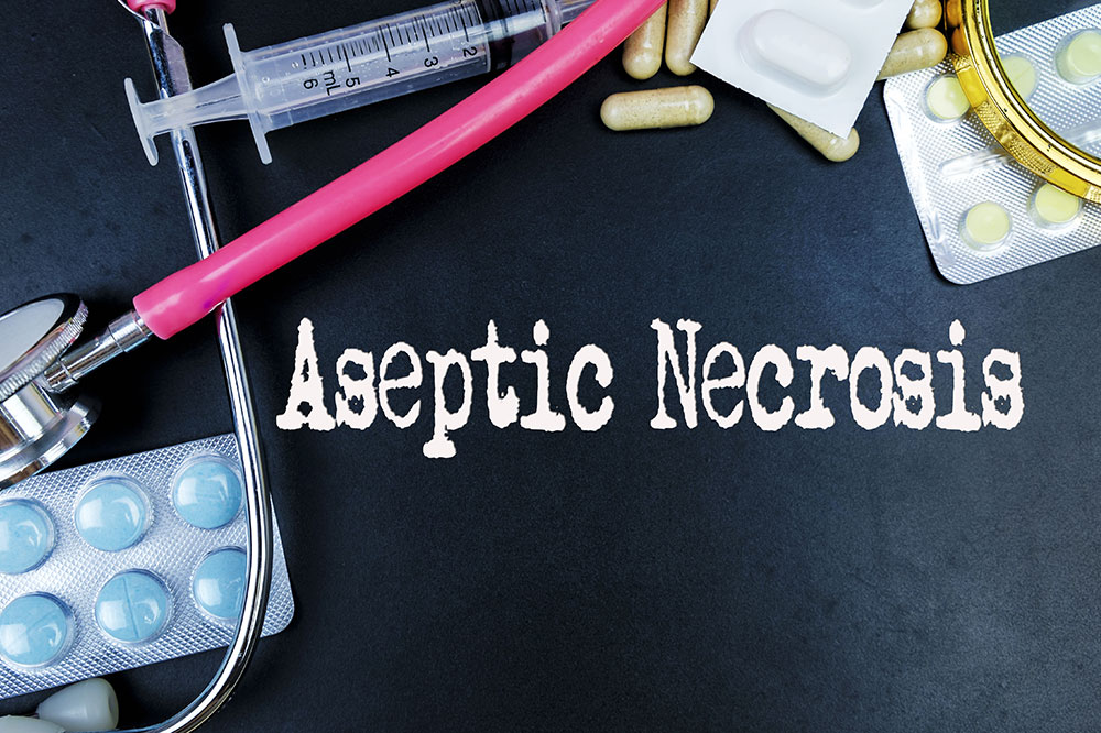 Aseptic necrosis – Symptoms, causes, and management