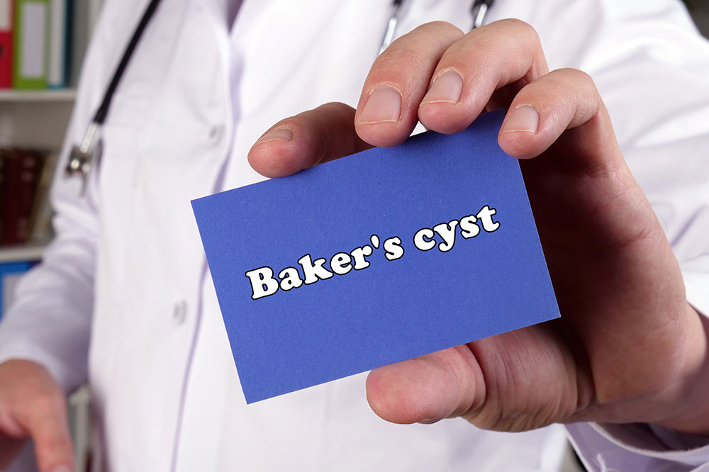 Baker’s cyst – Symptoms, causes, and management