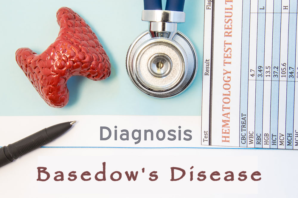 Basedow’s disease – Causes, symptoms, diagnosis, and management