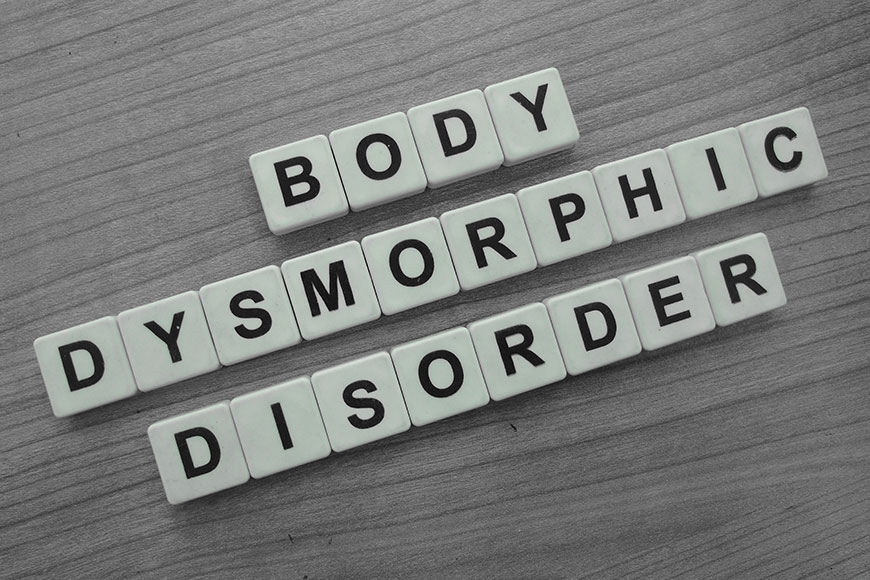 Body dysmorphic disorder – Symptoms, diagnosis, and management