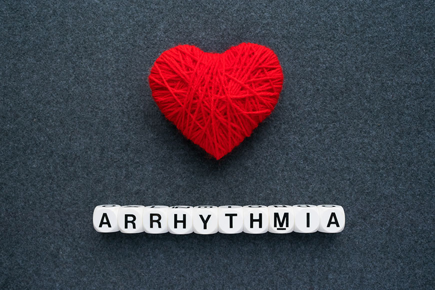 How to identify and manage arrhythmia