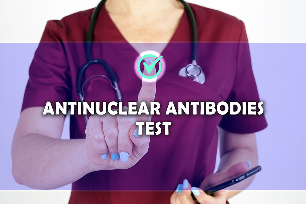 Key features of the antinuclear antibody test