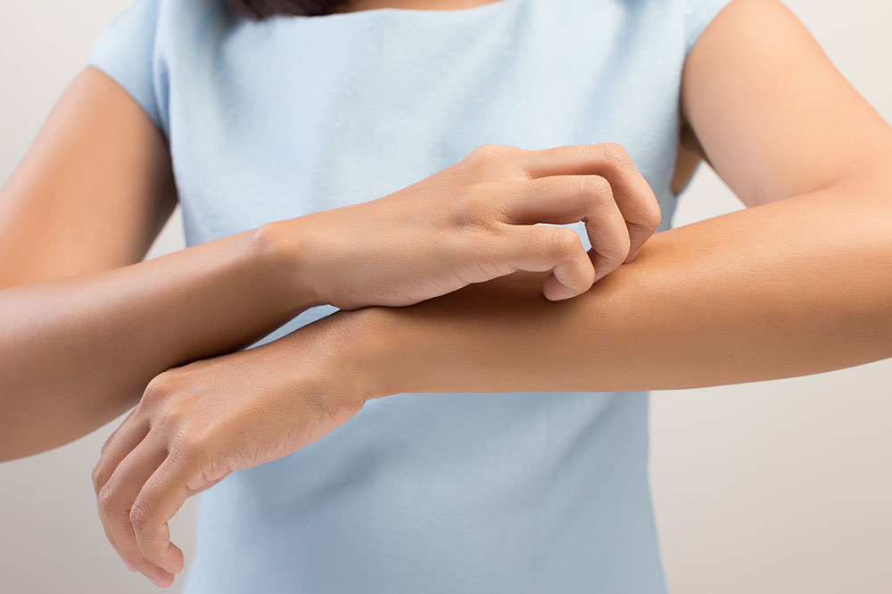 Symptoms of mosquito bites and how to manage them