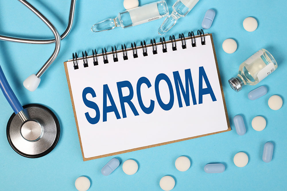 Synovial sarcoma – Symptoms, causes, and management