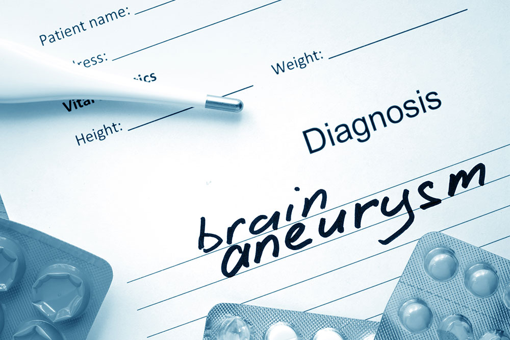 Things to know about a brain aneurysm